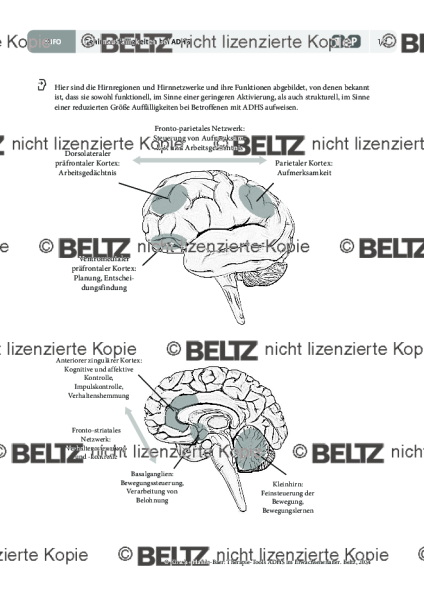 Gehirnauffälligkeiten bei ADHS im Erwachsenenalter